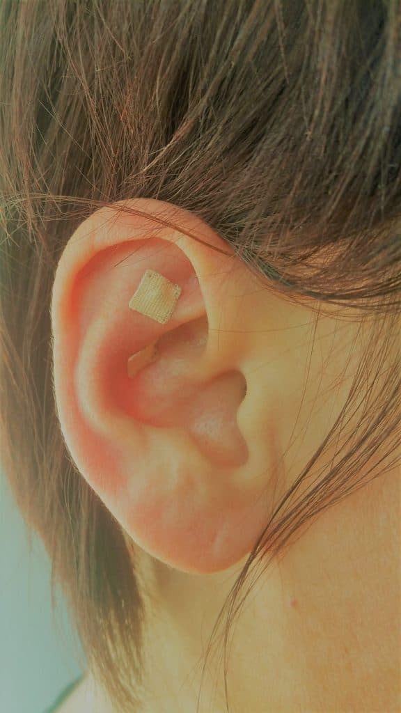 Auriculothérapie - points réflexes